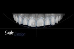 clínica dental Viladecans
